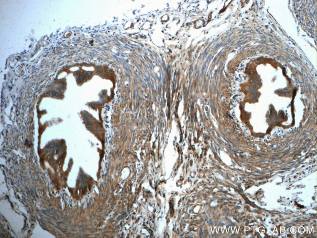 GCSH Antibody in Immunohistochemistry (Paraffin) (IHC (P))