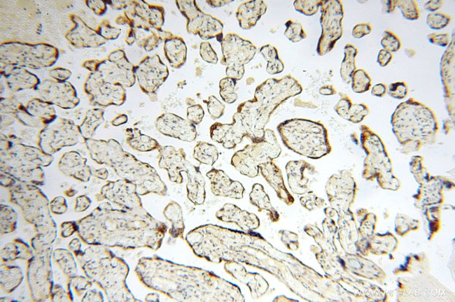 GCSH Antibody in Immunohistochemistry (Paraffin) (IHC (P))