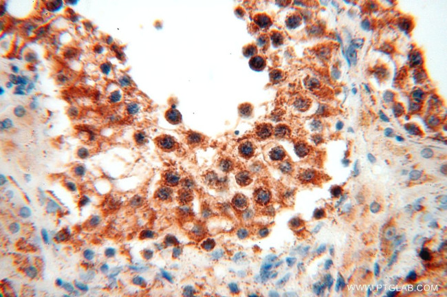 GCSH Antibody in Immunohistochemistry (Paraffin) (IHC (P))