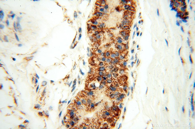 GCSH Antibody in Immunohistochemistry (Paraffin) (IHC (P))