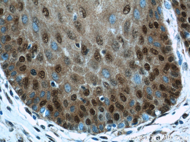 TRMT6 Antibody in Immunohistochemistry (Paraffin) (IHC (P))