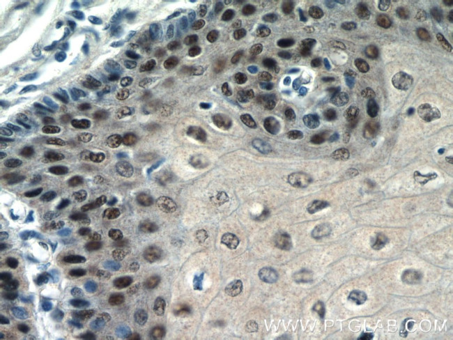 TRMT6 Antibody in Immunohistochemistry (Paraffin) (IHC (P))