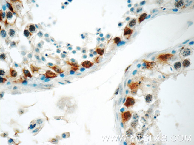 TRMT6 Antibody in Immunohistochemistry (Paraffin) (IHC (P))