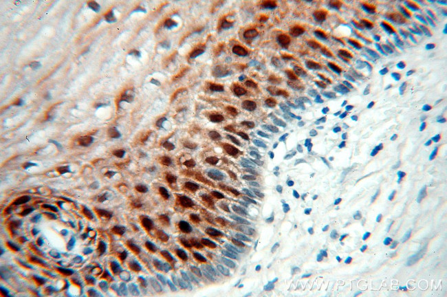 Galectin-7 Antibody in Immunohistochemistry (Paraffin) (IHC (P))