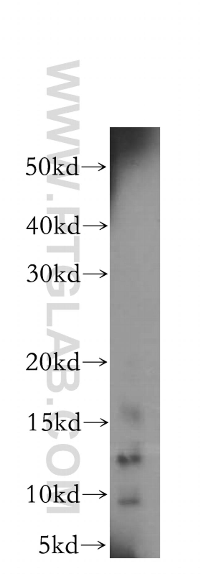 Galectin-7 Antibody in Western Blot (WB)