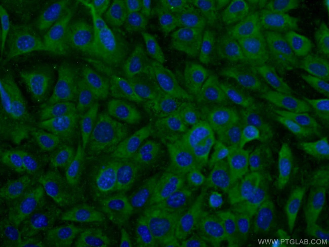 EXOSC10 Antibody in Immunocytochemistry (ICC/IF)