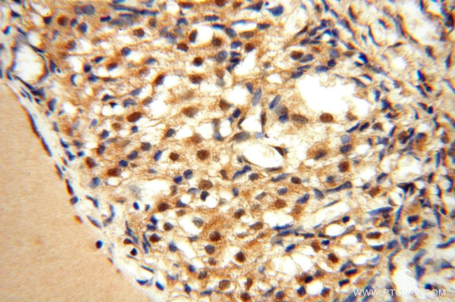 EXOSC10 Antibody in Immunohistochemistry (Paraffin) (IHC (P))