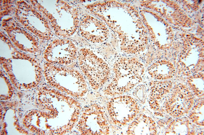 EXOSC10 Antibody in Immunohistochemistry (Paraffin) (IHC (P))