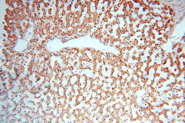 EXOSC10 Antibody in Immunohistochemistry (Paraffin) (IHC (P))