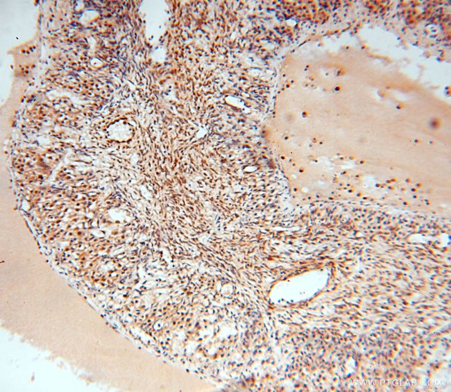 EXOSC10 Antibody in Immunohistochemistry (Paraffin) (IHC (P))