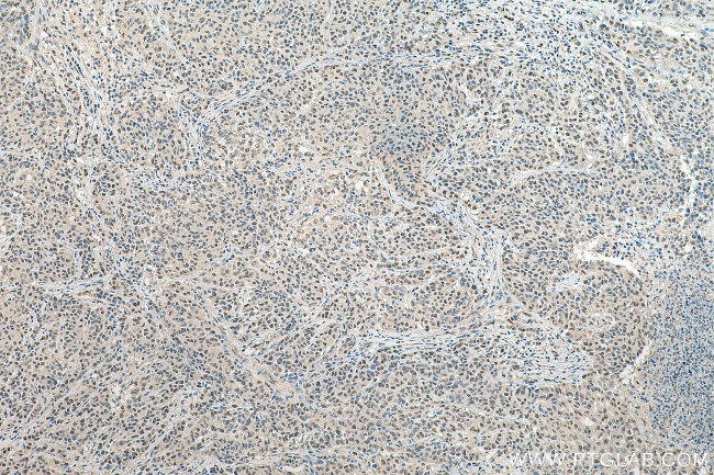 EXOSC10 Antibody in Immunohistochemistry (Paraffin) (IHC (P))