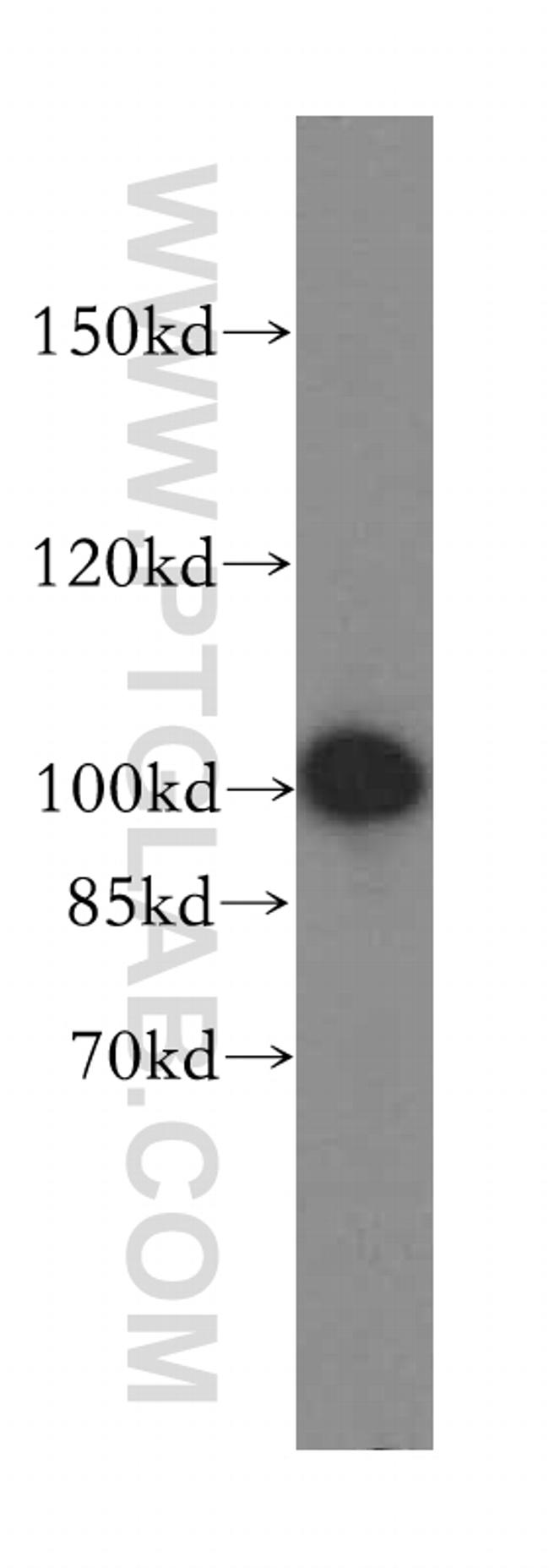 EXOSC10 Antibody in Western Blot (WB)