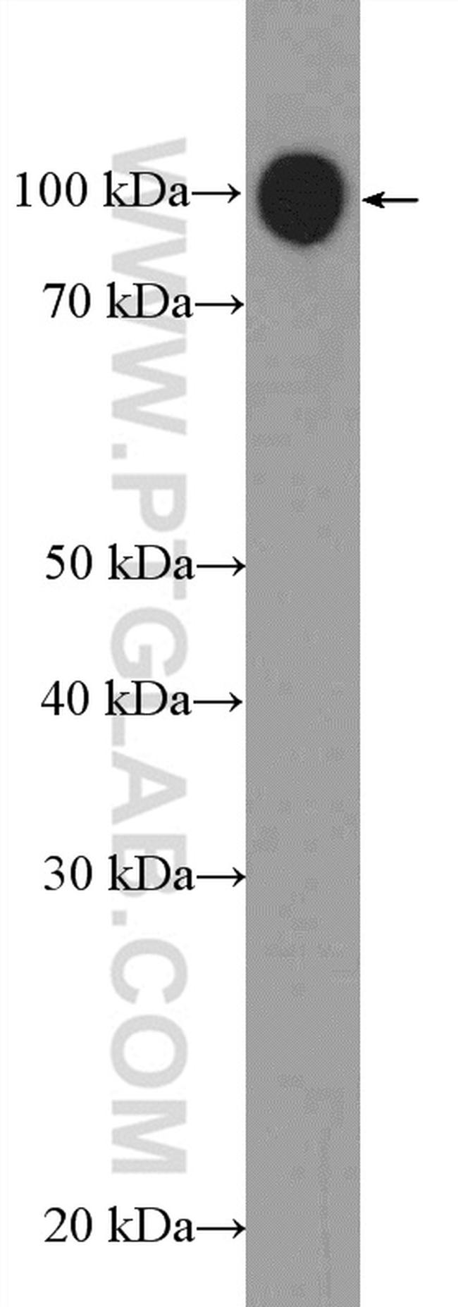 EXOSC10 Antibody in Western Blot (WB)