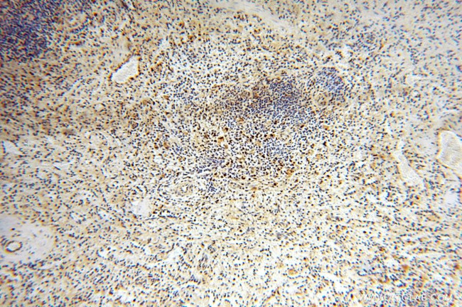 EXOSC10 Antibody in Immunohistochemistry (Paraffin) (IHC (P))