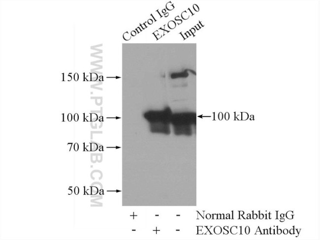 EXOSC10 Antibody in Immunoprecipitation (IP)