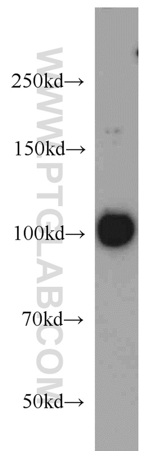 EXOSC10 Antibody in Western Blot (WB)