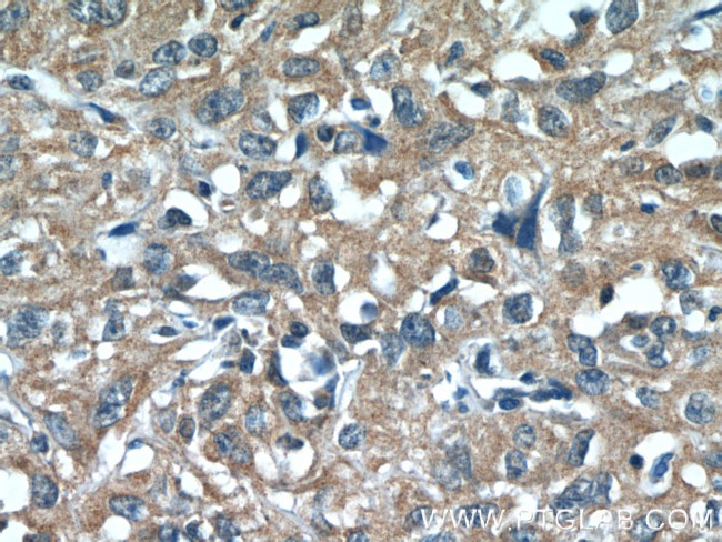 N4BP3 Antibody in Immunohistochemistry (Paraffin) (IHC (P))