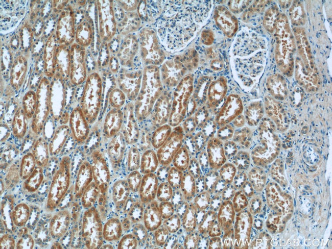 N4BP3 Antibody in Immunohistochemistry (Paraffin) (IHC (P))