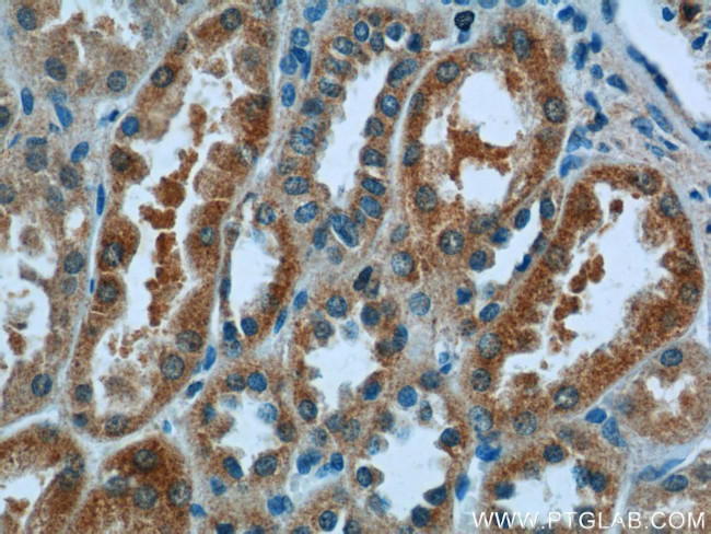 N4BP3 Antibody in Immunohistochemistry (Paraffin) (IHC (P))