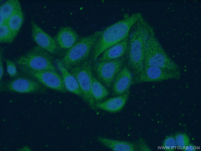 MRPS16 Antibody in Immunocytochemistry (ICC/IF)