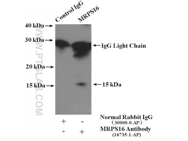 MRPS16 Antibody in Immunoprecipitation (IP)