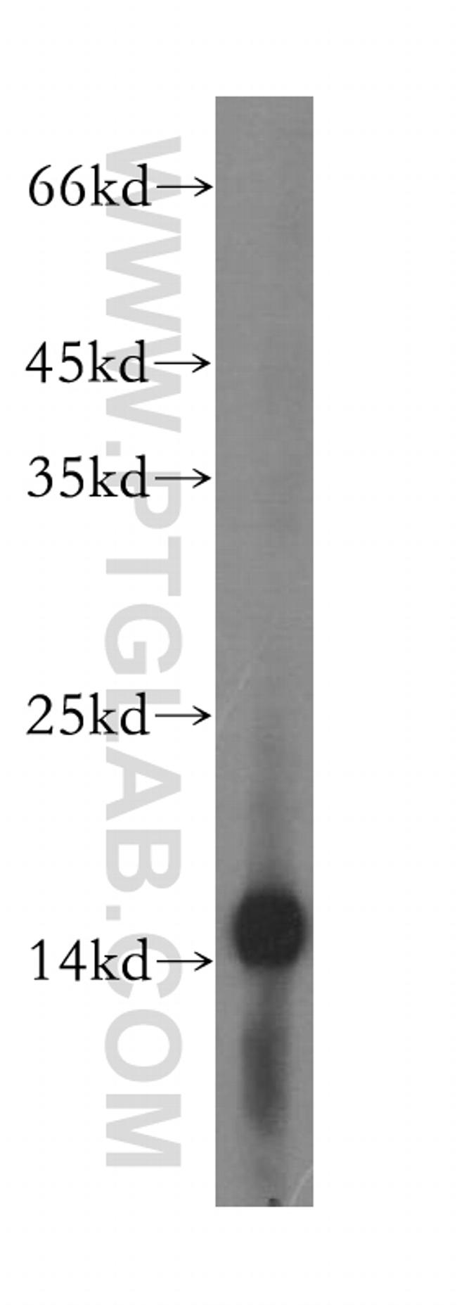 MRPS16 Antibody in Western Blot (WB)