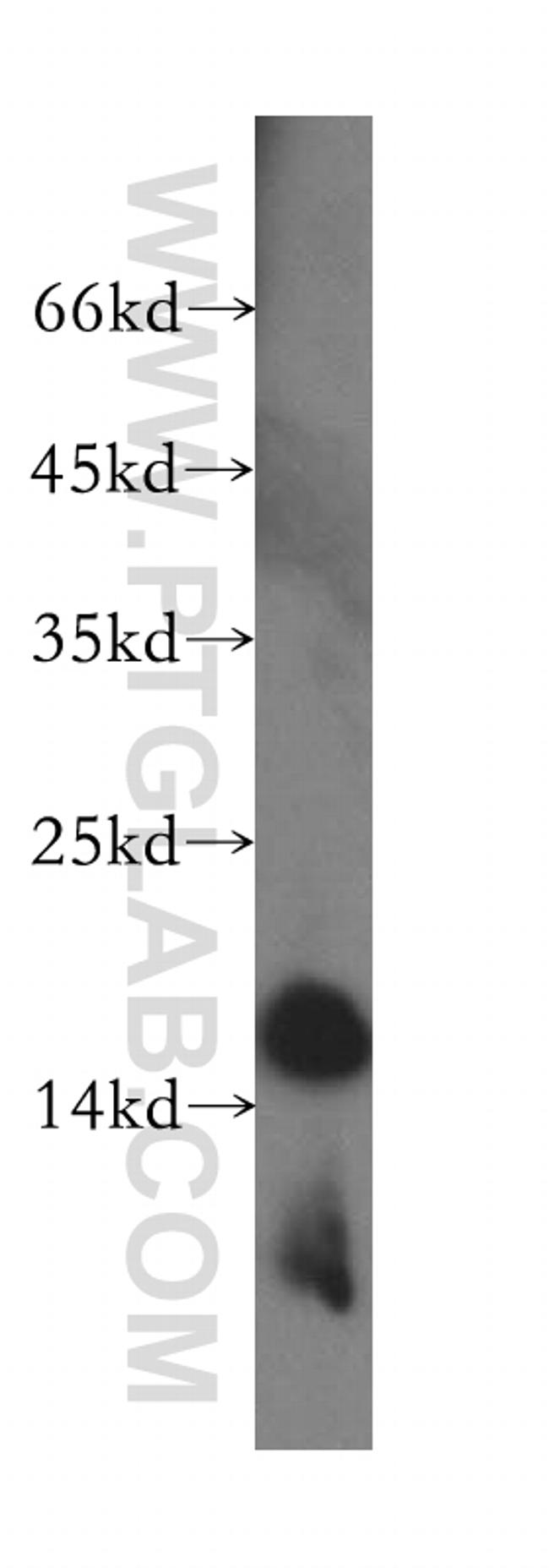 MRPS16 Antibody in Western Blot (WB)