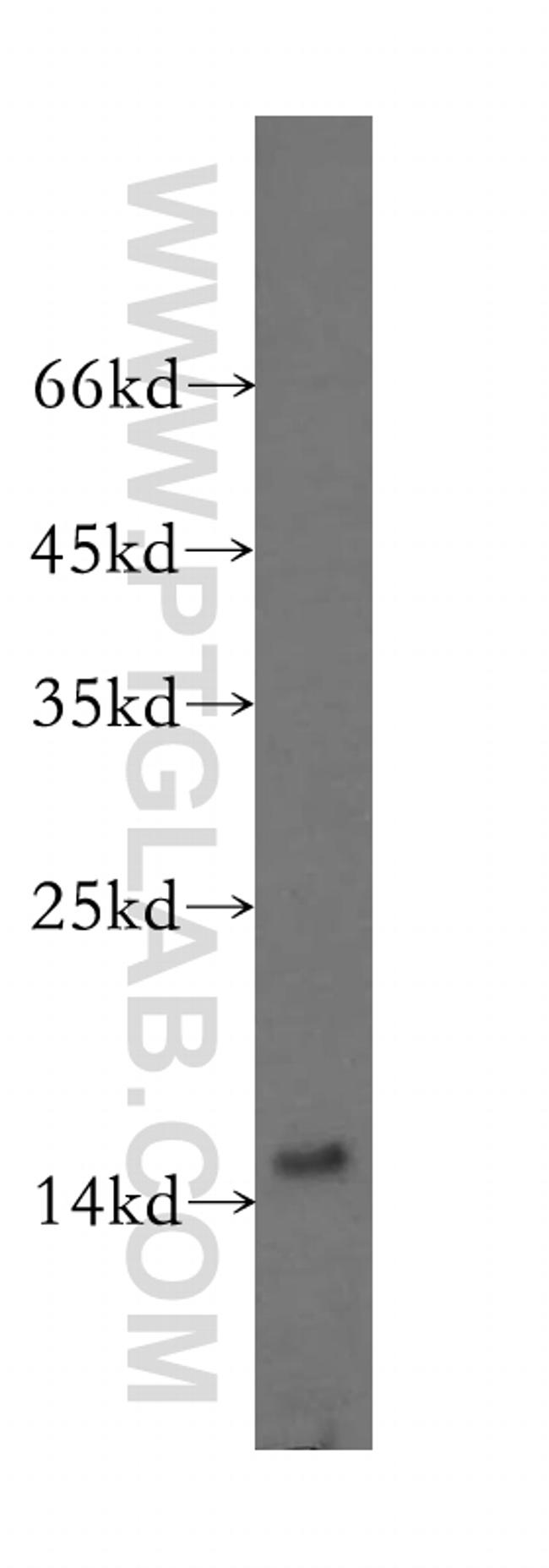 MRPS16 Antibody in Western Blot (WB)