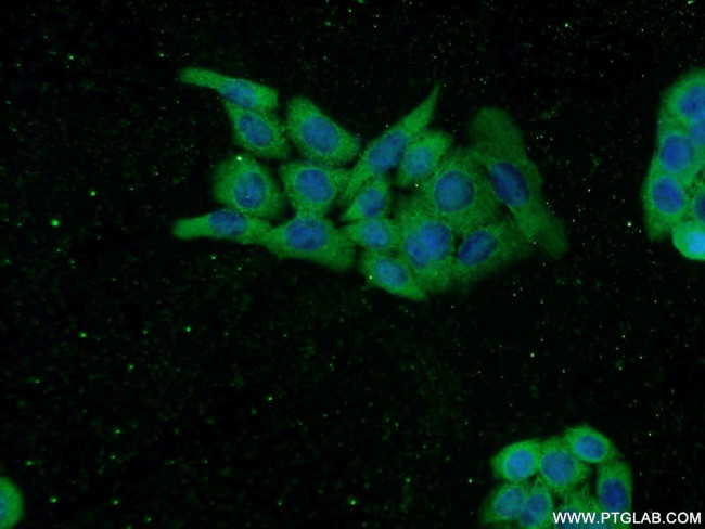 TASP1 Antibody in Immunocytochemistry (ICC/IF)