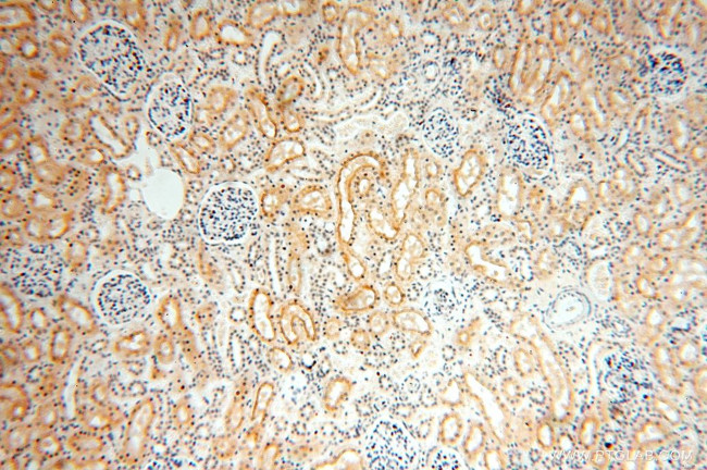 TASP1 Antibody in Immunohistochemistry (Paraffin) (IHC (P))