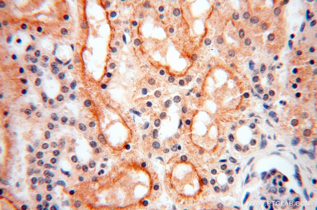 TASP1 Antibody in Immunohistochemistry (Paraffin) (IHC (P))