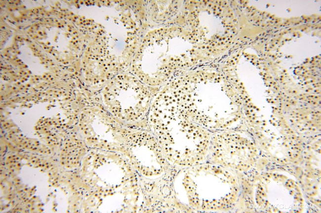 TASP1 Antibody in Immunohistochemistry (Paraffin) (IHC (P))