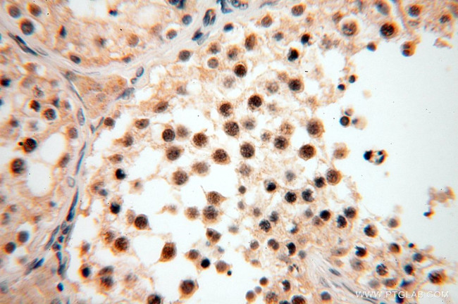 TASP1 Antibody in Immunohistochemistry (Paraffin) (IHC (P))