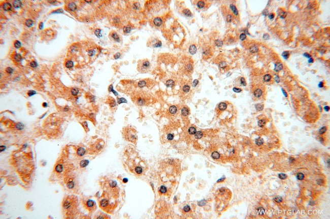 TASP1 Antibody in Immunohistochemistry (Paraffin) (IHC (P))