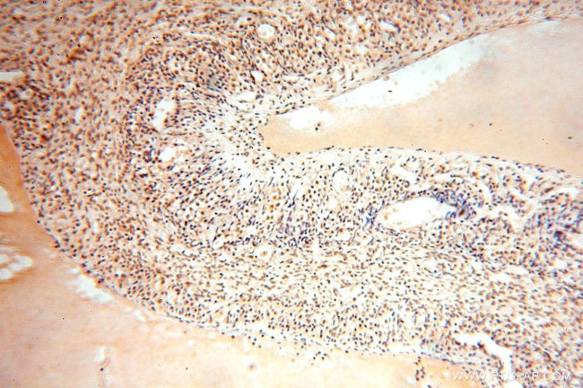 TASP1 Antibody in Immunohistochemistry (Paraffin) (IHC (P))