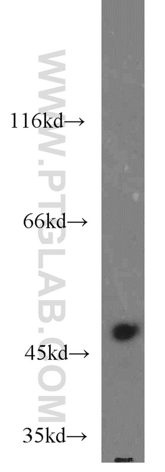 TASP1 Antibody in Western Blot (WB)