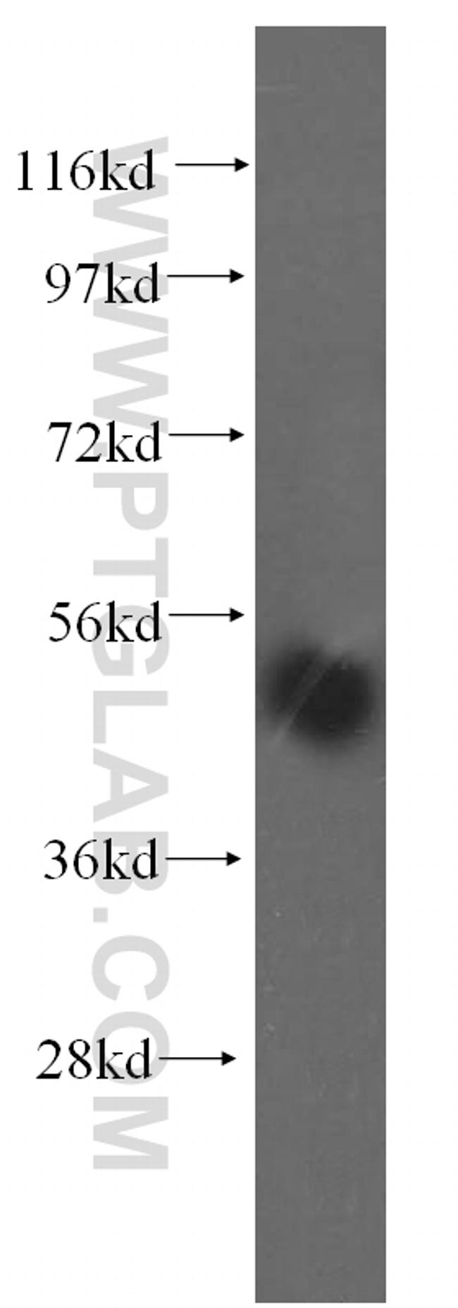 TASP1 Antibody in Western Blot (WB)