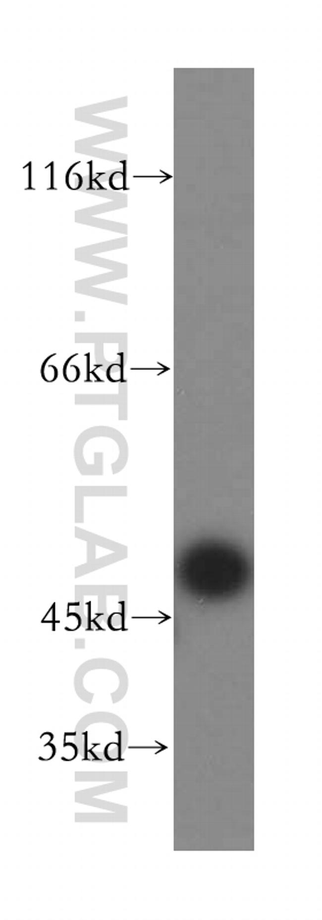 TASP1 Antibody in Western Blot (WB)