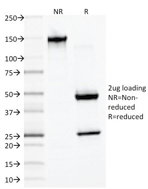 Desmin (Muscle Cell Marker) Antibody in SDS-PAGE (SDS-PAGE)