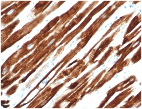 Desmin (Muscle Cell Marker) Antibody in Immunohistochemistry (Paraffin) (IHC (P))