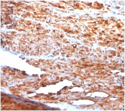 Desmin (Muscle Cell Marker) Antibody in Immunohistochemistry (Paraffin) (IHC (P))