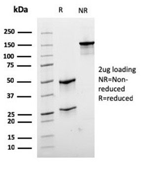 Desmin (Muscle Cell Marker) Antibody in SDS-PAGE (SDS-PAGE)