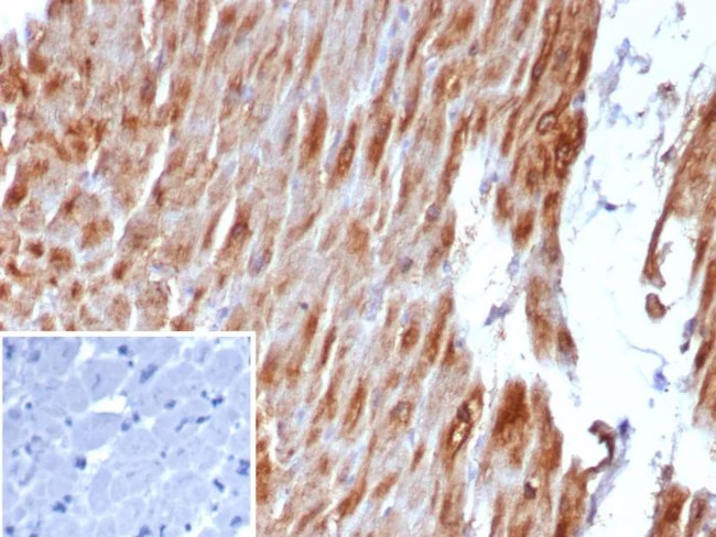 Desmin (Muscle Cell Marker) Antibody in Immunohistochemistry (Paraffin) (IHC (P))