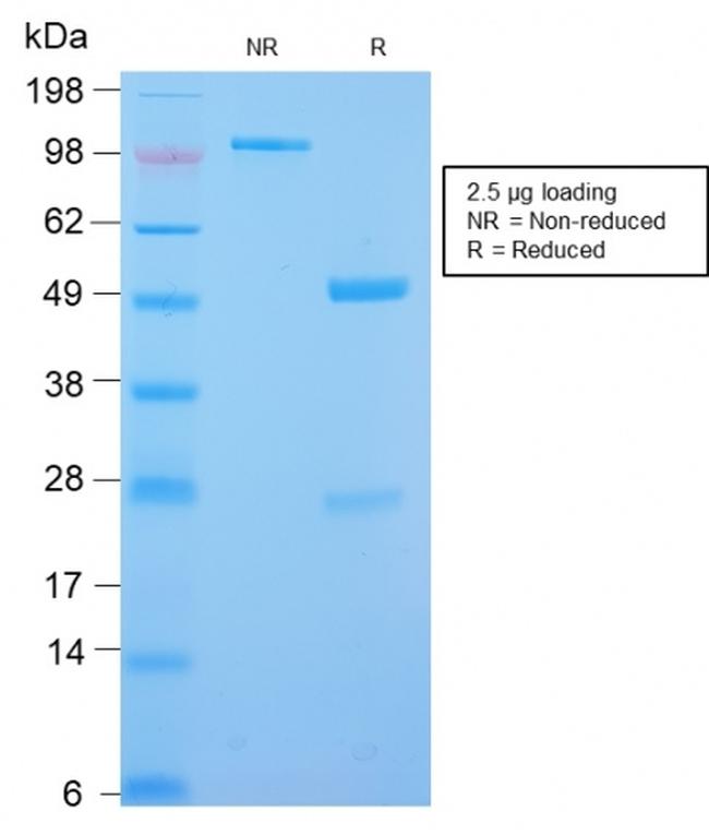 Desmin Antibody in SDS-PAGE (SDS-PAGE)