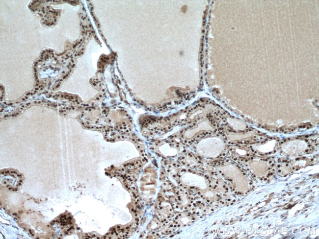 TBX3 Antibody in Immunohistochemistry (Paraffin) (IHC (P))