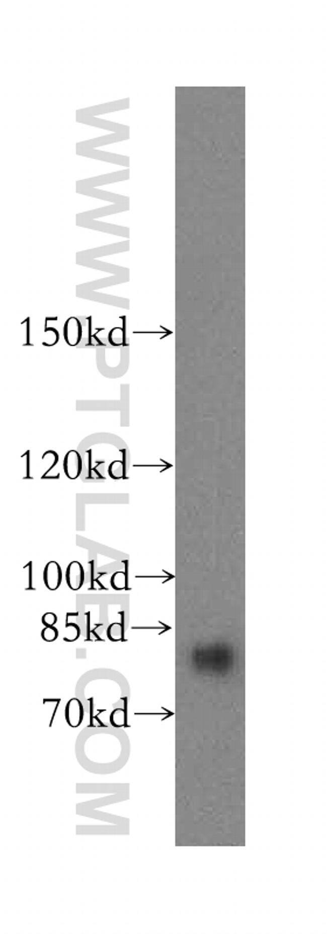 TBX3 Antibody in Western Blot (WB)