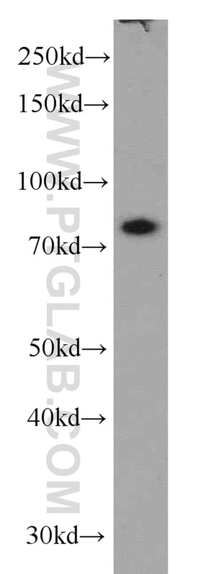 TBX3 Antibody in Western Blot (WB)