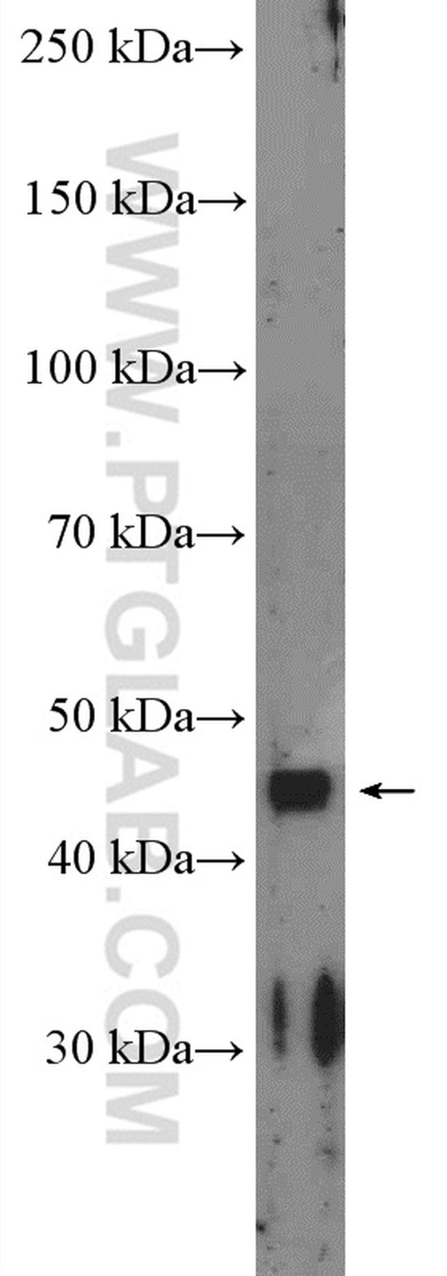 ACAD8 Antibody in Western Blot (WB)