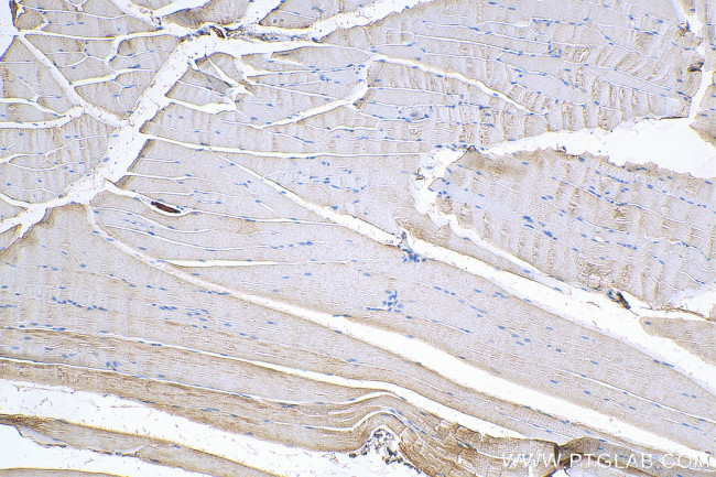 PHKG1 Antibody in Immunohistochemistry (Paraffin) (IHC (P))