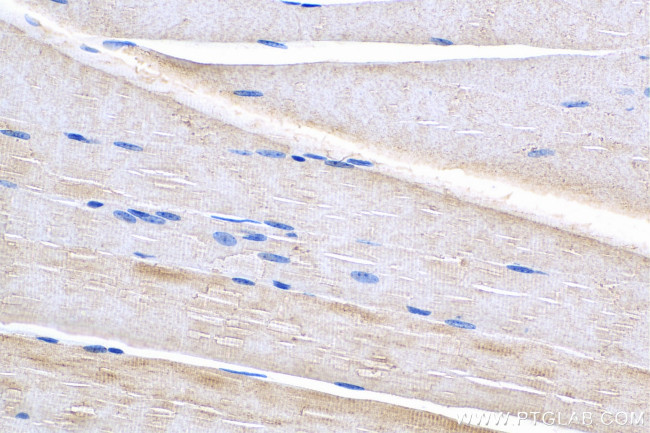 PHKG1 Antibody in Immunohistochemistry (Paraffin) (IHC (P))